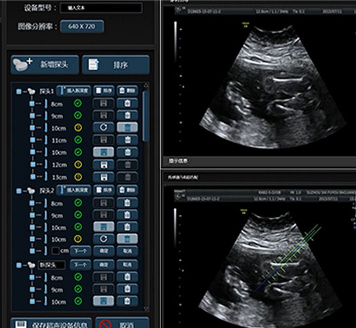 醫(yī)療超聲cs界面設(shè)計